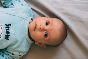 Circuncisión en Bebé recién nacidos
